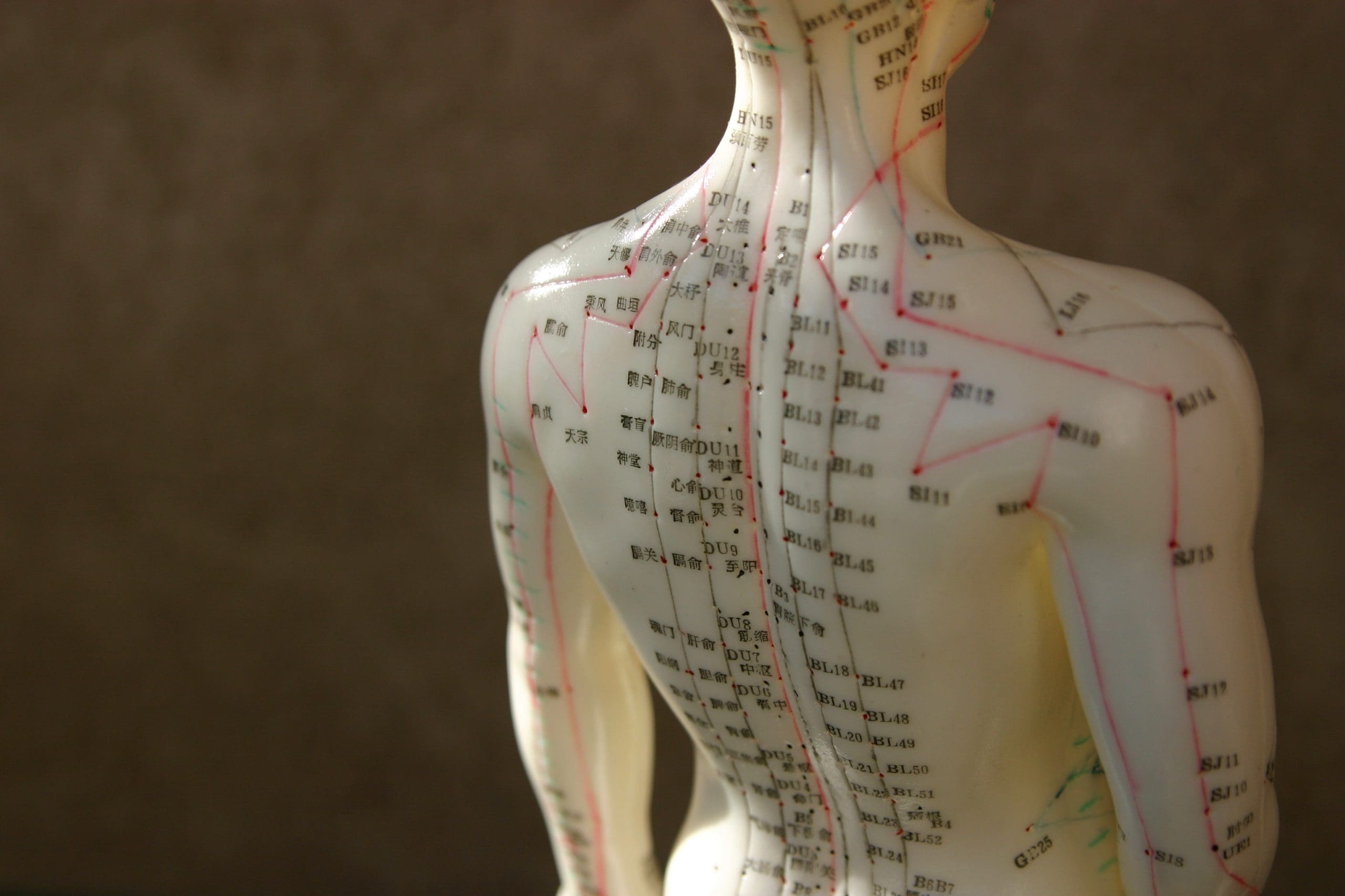Why You Should Try Acupuncture Ohana Wellness Clinic West Toronto