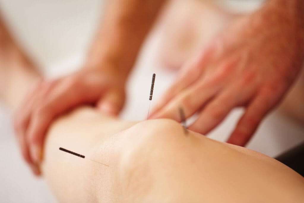 medical acupuncture appointment in Bloor West Village, Toronto.